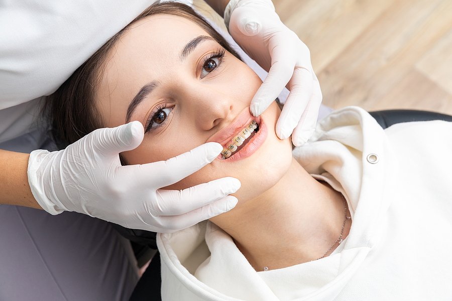 The Benefits of Braces
