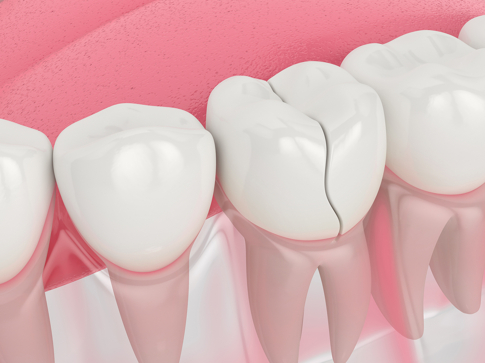 From Healing to Success: The Importance of Post-Operative Care for Implants 